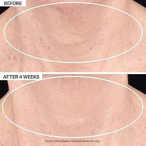 StriVectin Tighten & Lift Advanced LIGHT Neck Cream for Neck & D?collet?, Smoothing Look of Wrinkles & Fine Lines, Improves Crepey Skin, Light Texture