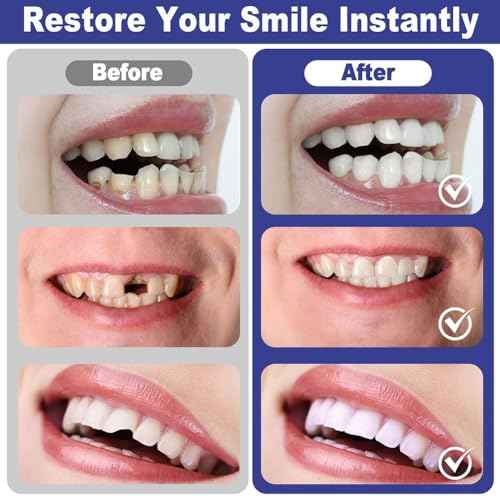 Temporary Tooth Provisional Kit - DIY Heat Beads for Missing or Broken Teeth, Dental Restoration & Replacement