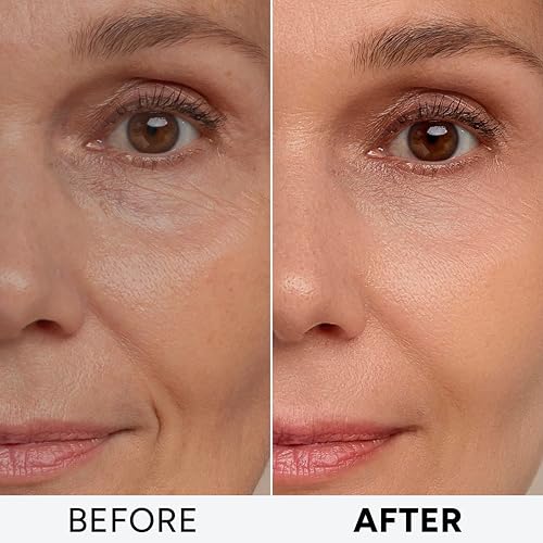 Retinol Cream for Face with Collagen, Peptides - Anti Aging Wrinkle Cream for Women and Men - Day-Night Facial Moisturizer with Hyaluronic Acid - Tightening and Skin Firming - Neck & D?collet?
