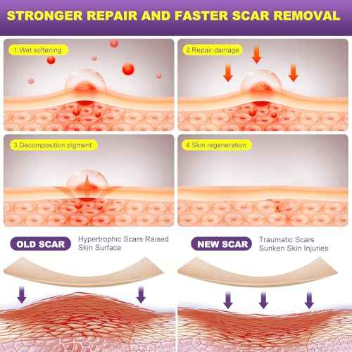 Silicone Scar Sheets, Silicone Scar Tape, Scar Tape for Keloid Bump Removal, Reusable Silicone Scar Strip for C-Section, Keloid, Surgery, Burns, Acne Scar et(1.8¡±x157¡±Roll-4M)