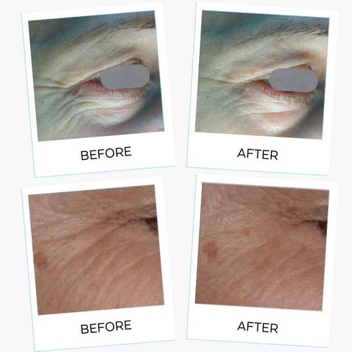 YUNASENCE LA NOUVEL Cellular Nutri Serum with Vitamin B12+D3, Matrixyl 3000, Argireline, Stem Cells & CoQ10, 1oz Antiaging, firming, lifting.