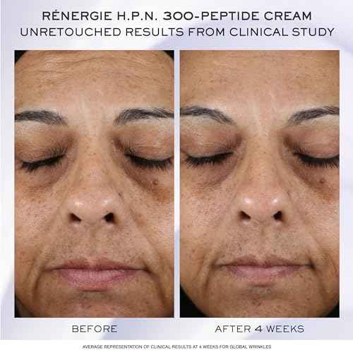 Lanco?me R?nergie H.C.F. Triple Serum Discovery Set