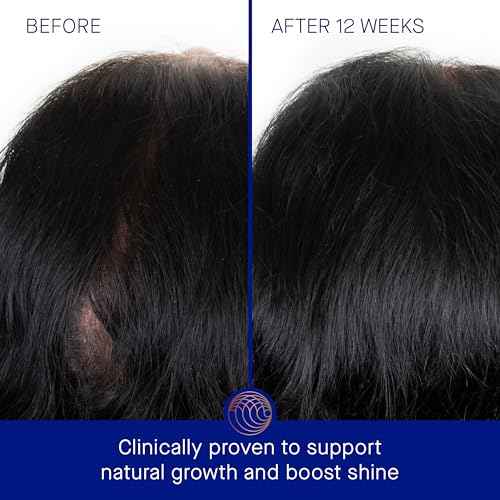 Augustinus Bader The Scalp Treatment