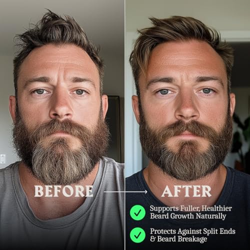 Striking Viking Beard Balm & Beard Oil for Men ? Unscented, 1 Fl Oz Each - Dual-Use Leave In Conditioner - Tames, Styles & Moisturizes ? With Naturally-Derived Argan & Jojoba Oil