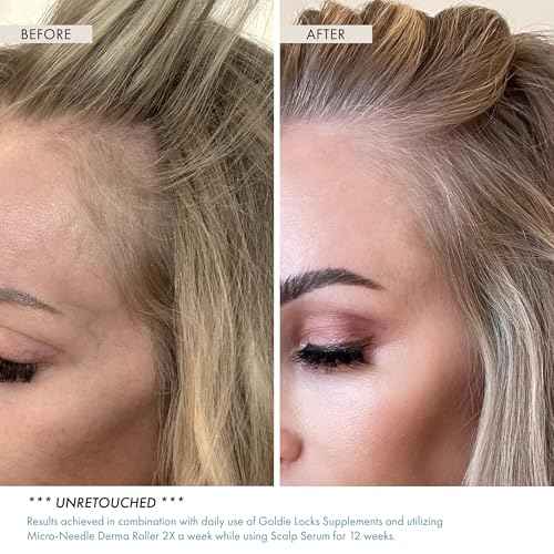 Goldie Locks Scalp Serum - Supports Fuller-Looking Hair and Healthy Scalp - Hydrating Lightweight Formula - Safe for Extensions & Color-Treated Hair - Protein-Free - 1.86 oz