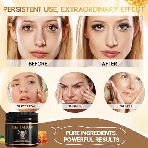 Beef Tallow for Skin, Grass-Fed Beef Tallow and Honey Balm with Olive Oil, Whipped Face Moisturizer Cream for Body, Natural Formula for Dry & Sensitive Skin, Light Scent (2.11, Unscented)
