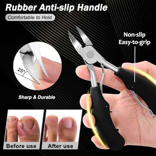 Toenail Clippers for Thick Toenails, Trimlyx Heavy Duty Toe Nail Clippers for Thick Nails for Seniors, Ingrown Nail Clippers for Men, Large Slanted Nail Clippers for Seniors Thick Nails 5Pcs