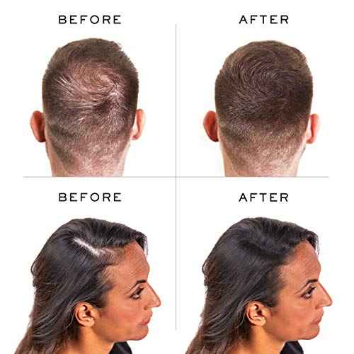 Nanogen Keratin Hair Fibers,, 30-grams, Black