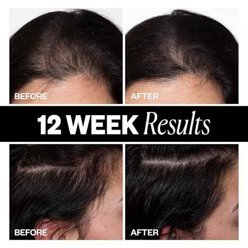 IGK Sponsored - Scalp Treatment for Hair Growth ? Hair Thickening Serum for Women ? Promotes Fuller, Thicker Hair ? Scalp Serum for Hair Density and Thinning - 2.1oz