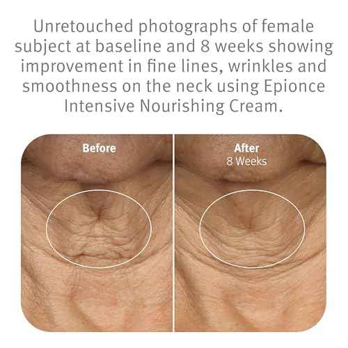 Epionce Intensive Nourishing Cream ? Rich Anti-Aging Moisturizer for Face, Neck & D?colletage | Ceramides, Glycerin & Squalene | Targets Fine Lines, Dark Spots & Dryness | Dermatologist Skincare