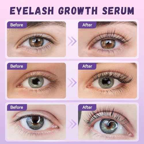 Eyelash Growth Serum, Premium Lash Serum Promotes Longer, Thicker£¨Gold£©