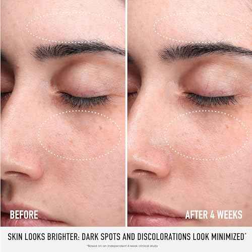 bareMinerals Skin Rescue Face Serum, Improve Skin Condition in 1 Week, Tested on Sensitive Skin, Vegan, 1 Fl Oz
