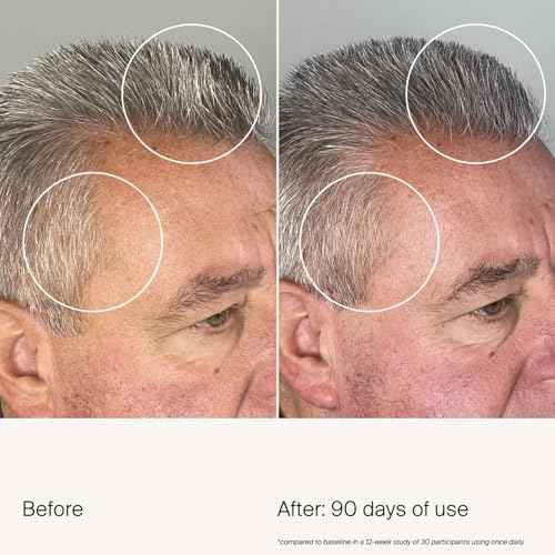 Living Proof Scalp Care Density Serum