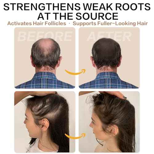 Root Activator Shampoo for Men and Women ? Rosemary & Boiton Hair Growth Shampoo for Thinning Hair, Hair Loss & Scalp Health ? Natural Herbal Formula with Cooling Sensation ? Sulfate-Free ? 10.1 fl oz