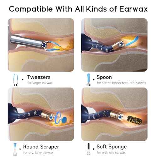 BEBIRD Ear Wax Removal Tool Camera, Visual Earwax Cleaner with Cleaning Kit as Spade/Spoon/Pick/Tweezer Clean Ears for Family, Ear-Scope Otoscope Wireless WiFi Connect