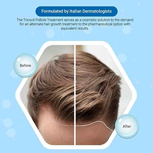 Tricovit Forte Hair Lotion - Hair Growth Serum With Androgen and DHT Blockers For Thinning Hair - Promotes Stronger, Thicker Hair For Men and Women - 5 Ampoules