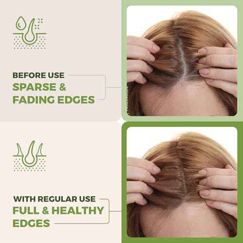 Premium Batana Oil for Hair Growth Blend -100% Natural Batana from Honduras, Castor & Rosemary Oil to Stimulate Hair Growth - Botana, Aceite De Batana - Natural Hair Products for Women & Men
