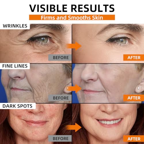 Super 22% Vitamin C Retinol Serum for Face: Advance Anti-Aging & Brightening Formula with Hyaluronic Acid, Niacinamide, Collagen, Peptides - Hydrates, Smooths, Targets Age Spots, Wrinkles, 1.7 Fl Oz