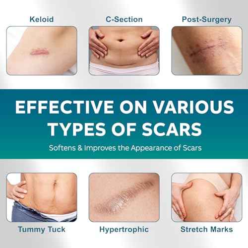 Silicone Scar Sheets, Silicone Scar Tape(1.6"x 120" Roll-300CM), Silicone Tape for Scars, Scar Tape for Surgical Scars, Silicone Scar Strips for C-Section, Tummy Tuck, Keloid, and Surgical Scars