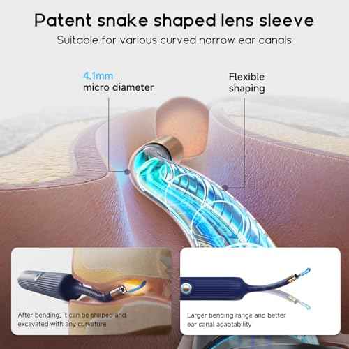 BEBIRD Ear Wax Removal Tool Camera, Visual Earwax Cleaner with Cleaning Kit as Spade/Spoon/Pick/Tweezer Clean Ears for Family, Ear-Scope Otoscope Wireless WiFi Connect