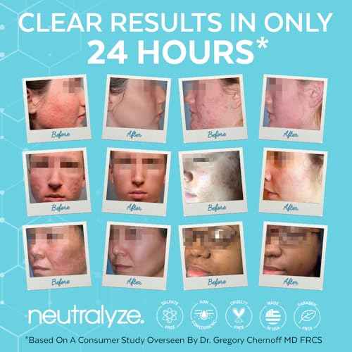 Neutralyze Moderate to Severe Acne Treatment Kit 2.0 - Maximum Strength 3 Step Acne Kit with 2% Salicylic Acid, 2% Mandelic Acid & Nitric Oxide - Includes Face Wash, Clearing Serum & Synergyzer