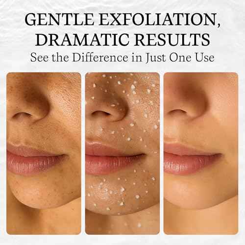 Vivo Per Lei Facial Peeling Gel - Face Peel with Dead Sea Minerals - Gentle Exfoliating Gel for Face - 4.05 Fl Oz - Pack of 4