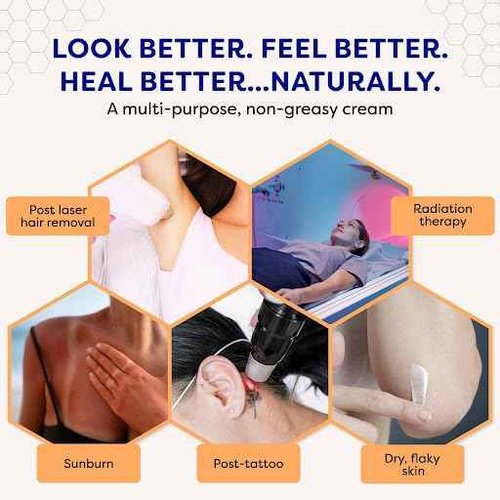 BeeCure Radiation Relief & Laser Burn Cream, 2 Fl Oz, Post-Procedure Care with Buckwheat Honey, Helps Calm Skin after Aesthetic Procedures & Sunburn, Clinically Tested Safe for Sensitive Skin