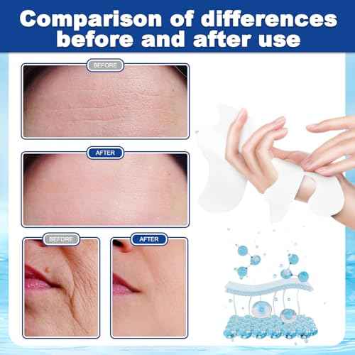 Forehead Wrinkle Patches and Smile Line Patches with Hyaluronic Acid, Aloe, Collagen & Vitamin E£¬Overnight Facial Wrinkle Patches to Lift Smile Lines for Women for Smoothing and Firming(36pcs)