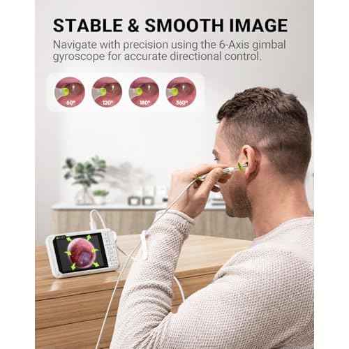 Anykit Digital Otoscope with Gyroscope, 4 Inches Screen, 3.9mm Ear Scope Camera with 6 Lights, Ear Wax Removal Tool, 32GB Card, Supports Photo Snap and Video Recording