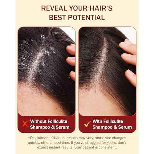 Folliculitis Treatment Shampoo & Serum with 3% BHA, Salicylic Acid, Tea Tree Oil & Chamomile Extracts - Anti Itch Shampoo for women & men with Flaky Scalp Treatment Acne, Made in USA by e70, 8 fl oz