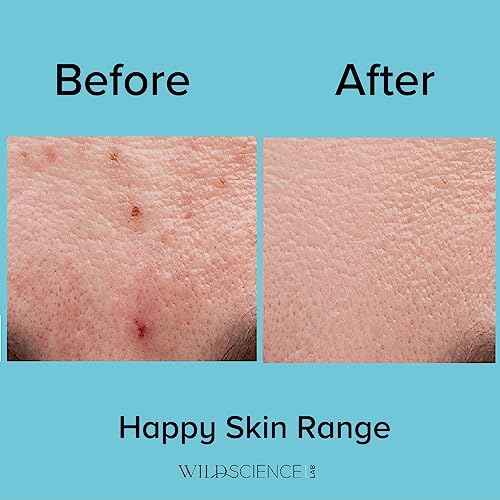 Wild Scicen Lab HAPPY BALANCE AHA + BHA + Zinc Clarifying Essence for Acne-Prone Skin