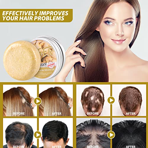 Natural Organic Ginger Hair Regrowth Shampoo Bar Soap for Anti Hair Loss, Dandruff, Itching - Promotes Hair Growth, All Hair Types (3 Pcs)