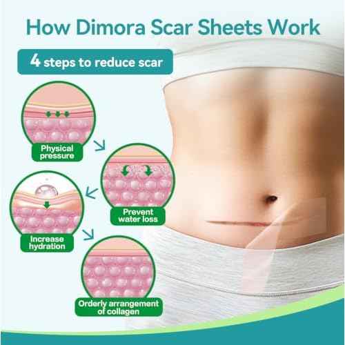 Dimora Medical Grade Silicone Scar Sheets -Ultra Soft Silicone Scar Tape (1.6¡±x60" Roll), Hypoallergenic Scar Removal Treatment for Surgical Scars, C Section, Tummy Tuck, Keloid Treatment