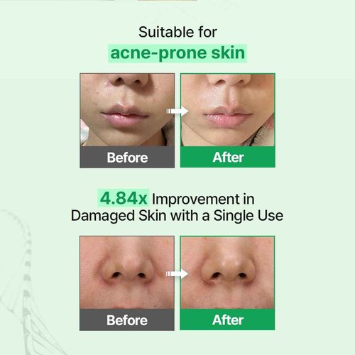 Zipiderm EGF Skin Barrier Cream Toner – Korean Milky Hydrating Toner for Dry, Sensitive & Acne-Prone Skin with Ceramides, Hyaluronic Acid, Rice Bran & Soy Protein, Moisturizing Skincare, 5.07 fl oz