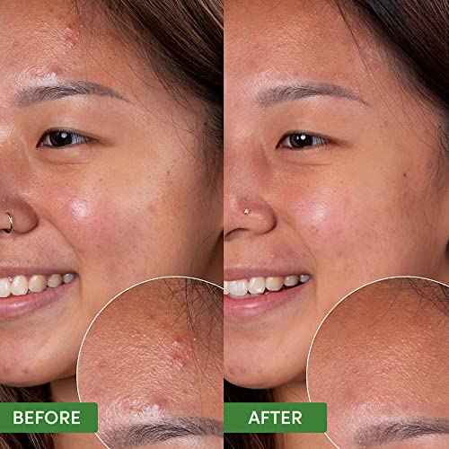 Sand & Sky Oil Control Gentle Face Cleanser with AHA & BHA - pH-Balanced Blemish Cleanser, Reduces Redness, For Oily Skin & Breakouts, 4.2 fl oz