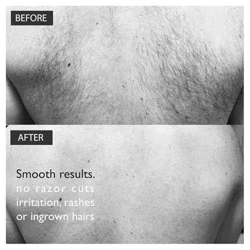 BALDAPE PARLOUR Body & Back Hair Removal Kit with Men's Depilatory Cream, Extendable Applicator & Loofah for Smooth, Hair-Free Results