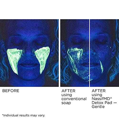 NassifMD Gentle Detox Pads, Surgeon-Created Fruit Acid Complex for Sensitive Skin, Brightens, Exfoliates & Reduces Wrinkles, Dermatologist-Tested
