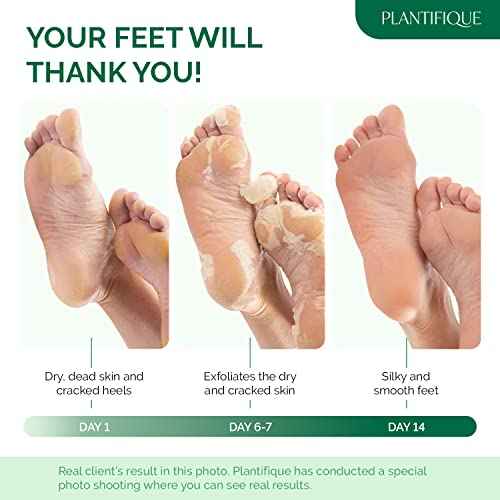 PLANTIFIQUE Foot Peeling Mask 2 Pack for Men | Dermatologically Tested Repairs Heels & Removes Dry Dead Skin for Baby Soft Feet | Exfoliating Foot Peel Mask for Dry Cracked Feet | Aloe Vera