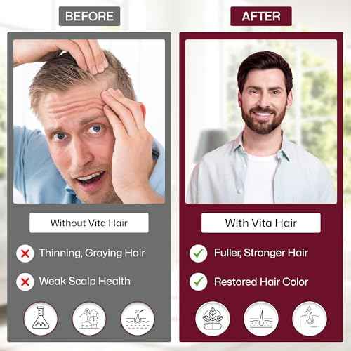 Vita Hair (Micronized Formula) Growth & Hair Loss Supplement ? 100% Natural for Healthier Hair ? Supports Hair Growth, Reduces Hair Loss, and Combats Graying for Men & Women ? 108 Capsules