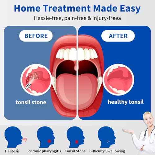 Tonsil Stone Remover with Camera£¬Tonsil Stone Removal Tool with LED Light£¬TonsilCleaner for Tonsil Stone Removal£¬Tonsillolith Removal Tool with 4 Head £¬Attachments for iOS & Android (Black and Gold)