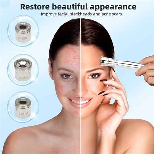 Diamond Microdermabrasion Machine Kit, 65-68cmHg Suction Power, 9 Replaceable Tips, Suitable for Face and Body (Home & Salon Use)