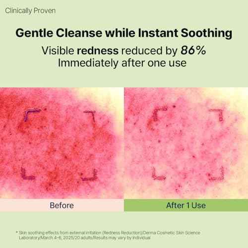 HYCICA Soothing Gentle Cleansing Foam | Low pH 5.5 Cleanser for Sensitive Skin, Calming Hydrating Cica Face Wash & Barrier Care, Centella, Ultra-Low Molecular HA, Korean Skincare, 5.07 fl oz