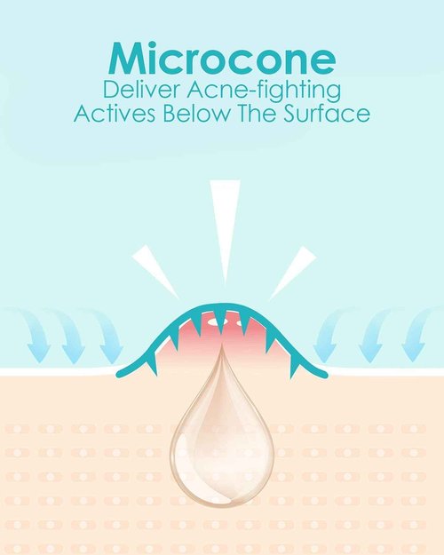 +1HEROLABS Microdart Acne Patch (72 Patches) - Hyaluronate, Salicylic Acid, Vitamin C, Microdart Pimple Patch for Deep, Early Stage and Hidden Pimples (72 Count (Pack of 1))