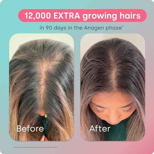 Biosil Advanced Hair Growth Formula - 30 Packets - Promotes Hair (re) Growth, Prevents Hair Loss and Shedding & Increases Thickness and Strength - with Patented ch-OSA - 1 Month Supply