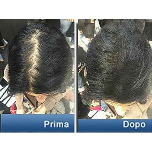 Pantogar (Pantovigar) Specific Treatment for Hair and Nails - 90 Cap