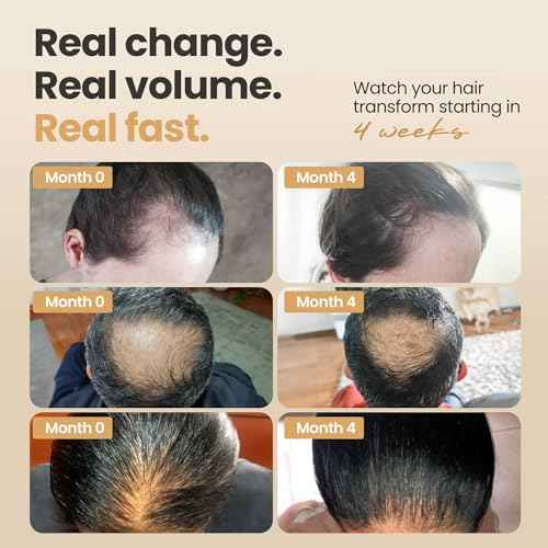 Vitasei Hair Booster 2 Fl Oz (2 Pack) ? Hair Revitalizing Serum with Capilia Longa, Wild Olive Stem Cells & Arginine ? Peptide-Enriched Hair Tonic Supports Thicker, Stronger Hair ? For Women & Men