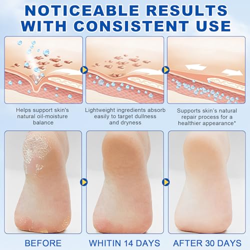60% Urea with 2% Salicylic Acid Urea Foot Care Stick, 2PCS Heel Stick for Cracked Feet, Foot Care Cream Moisturizer for Dry Cracked Feet, Knees, Elbows, Hands, Foot Lotion Stick
