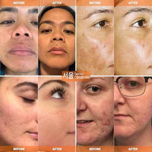 SeoulCeuticals Large 2oz Korean 20% Vitamin C Hyaluronic Acid Serum + CE Ferulic Acid - Potent Anti Aging Vit C, Anti Wrinkle K Beauty Skincare