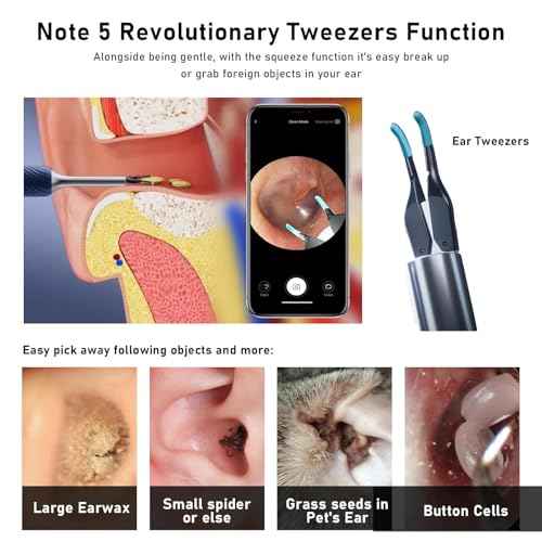 Note5 Ear Wax Tweezers with Camera, 10MP Ear Cleaner Camera Otoscope with Light,Real-time Remote Video with Ear Pick & Tweezers,12 Pcs Ear Scoops for Whole Family