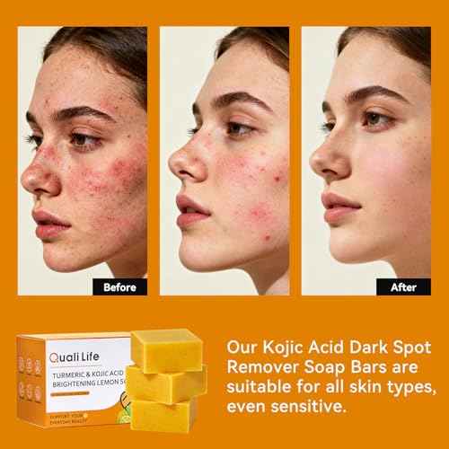 Turmeric Soap For Dark Spot - Kojic Acid Soap Bar with Vitamin C for Face & Body, Natural Ingredients Handmade Soaps for Brightening & Moisturizing, 3 Bars